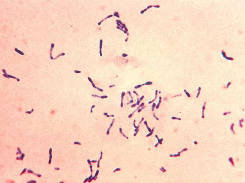Дифтерийная бактерия под микроскопом