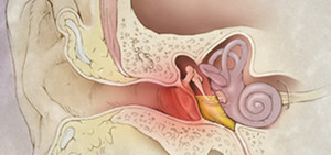 Отит - воспаление среднего уха