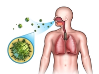 Как передается пневмония