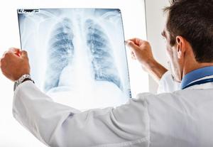 Как проявляется туберкулез