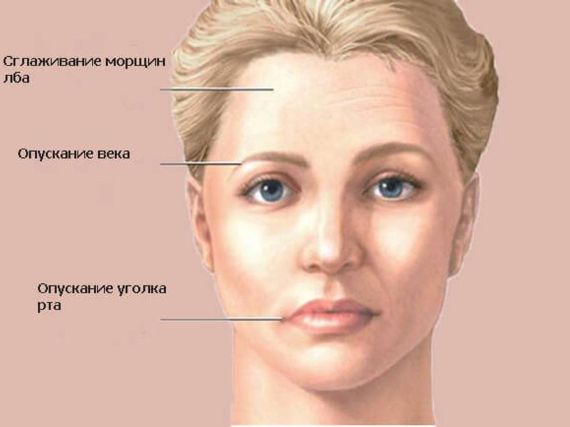 Лечение лицевого и тройничного нервов.