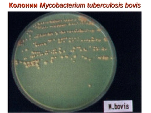 Рост колоний микобактерии на чашках Петри